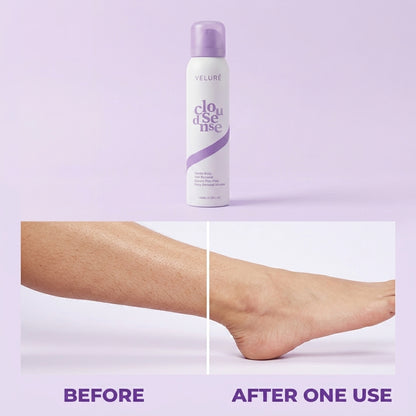 Hair Removal Mousse